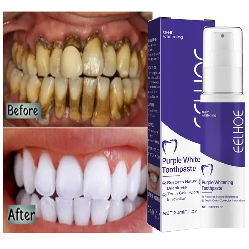 Teeth Whitening In Korea - Pasta de dientes piezas limpieza dental,