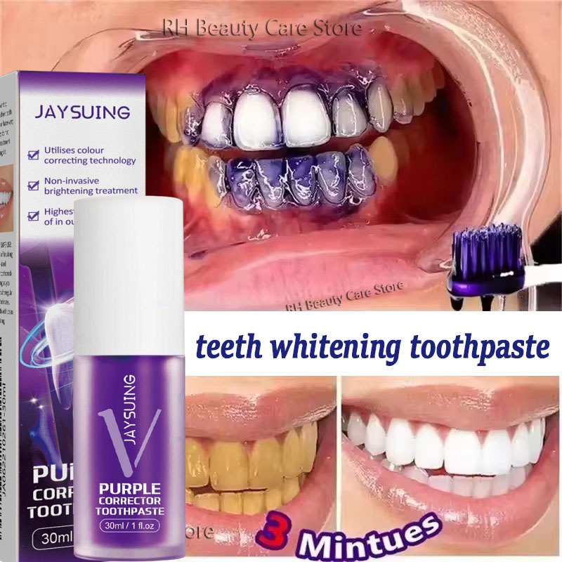Teeth Whitening In Korea - Pasta Dental Blanqueadora, Gel Blanqueador, Elimina