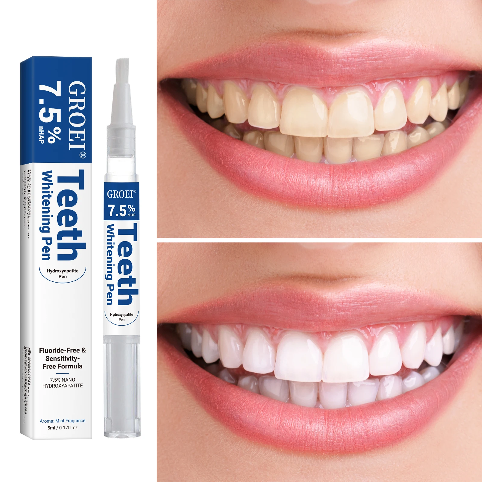Pluma blanqueadora de dientes  - Teeth Whitening Before And After reseña y precio