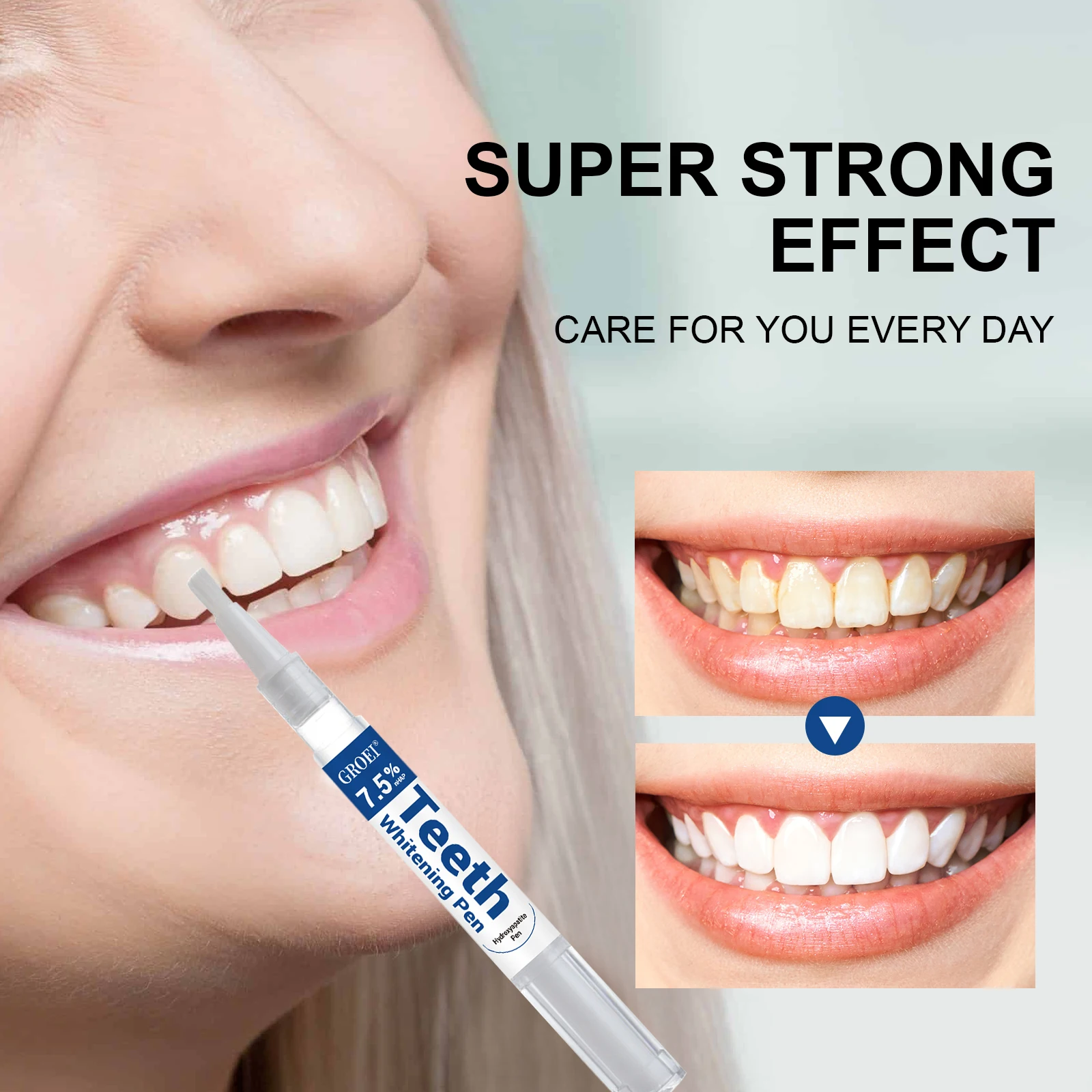 Pluma blanqueadora de dientes  - Teeth Whitening Before And After reseña y precio