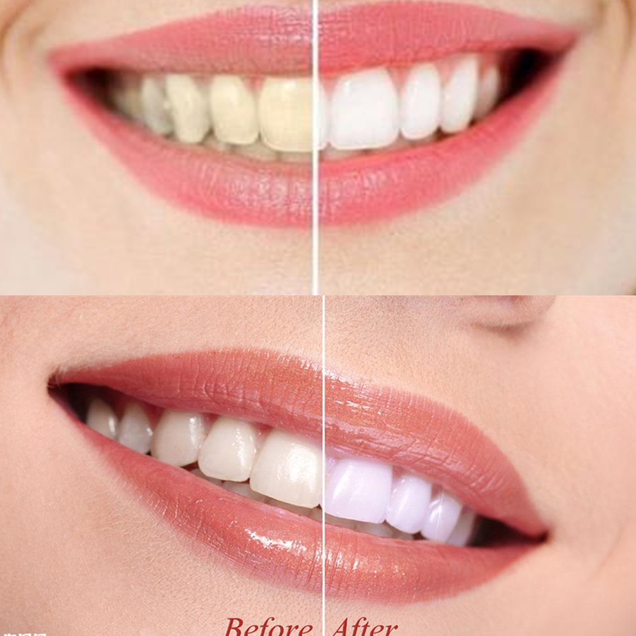 Dientes de carbón de bambú par - Teeth Whitening Instant reseña y precio