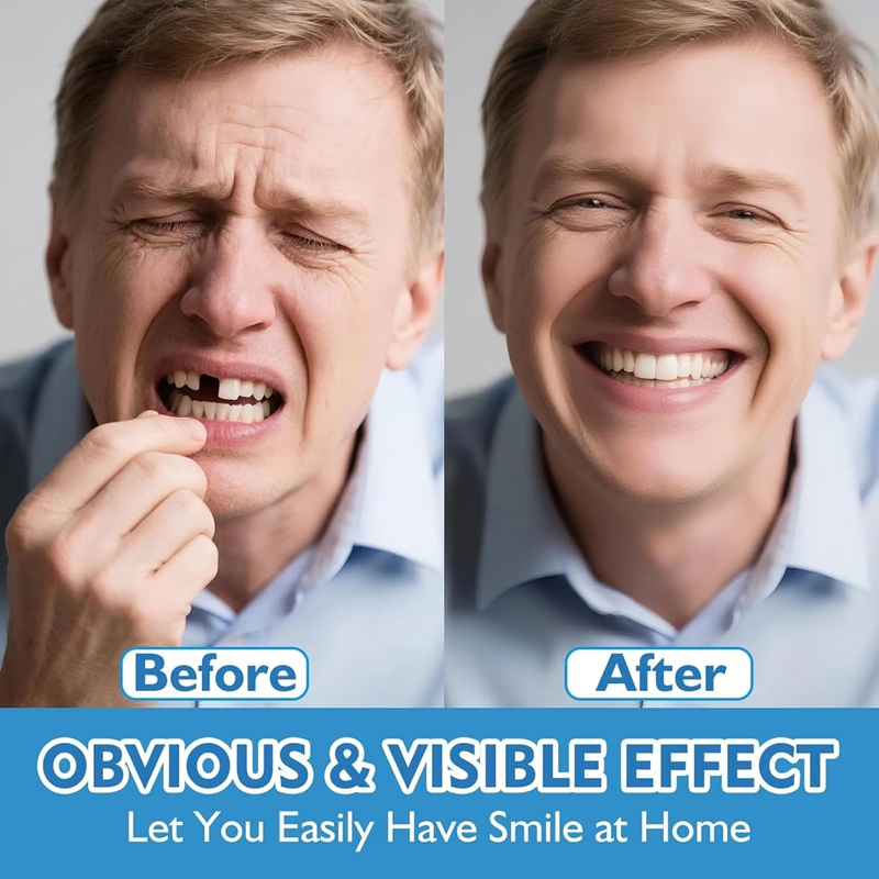 Juego Completo de Dentaduras d - Teeth Whitening Instant reseña y precio