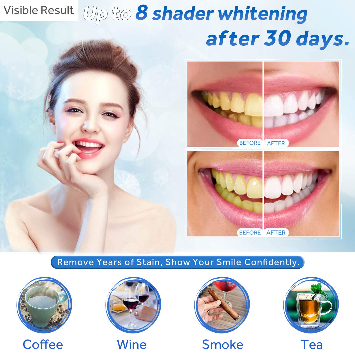 Jeringa de repuesto de Gel par - Teeth Whitening Before And After reseña y precio