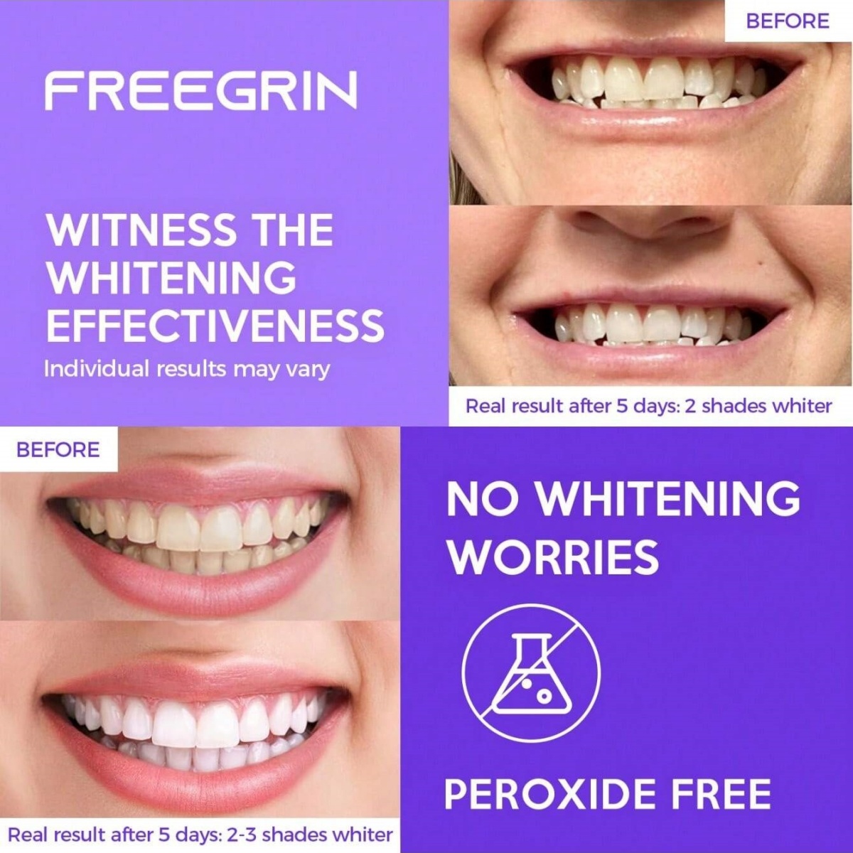 Pegatinas blanqueadoras de die - Teeth Whitening Before And After reseña y precio